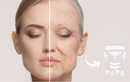LipoFace™ - Kit Adesivos Reutilizáveis Anti Rugas